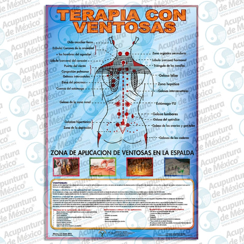 GRAF TERAPIA CON VENTOSAS