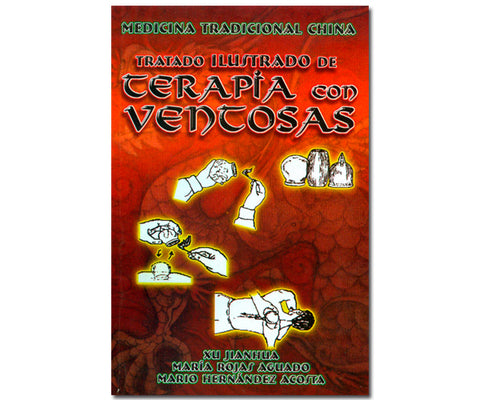 TERAPIA CON VENTOSAS
